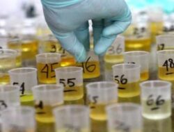 Urine Empat Terduga Pengedar Positif 