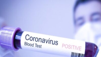 Obati Pasien Positif Corona, Seorang Dukun Kampung Terpapar