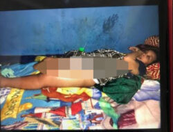 Kaki Tati Marlina Digerogoti Kanker Tulang