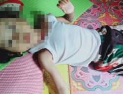 Bocah Diduga Alami Gizi Buruk di Dharmasraya