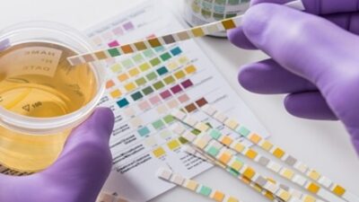 Pemeriksaan Narkotika Menggunakan Sampel Biologis
