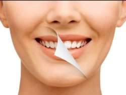 5 Cara Memutihkan Gigi dengan Bahan-bahan Alami