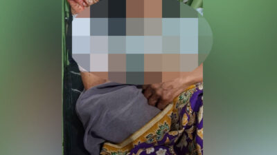 Tiga Warga Sinuruik Luka-luka Diserang Beruang Madu saat Panen Padi