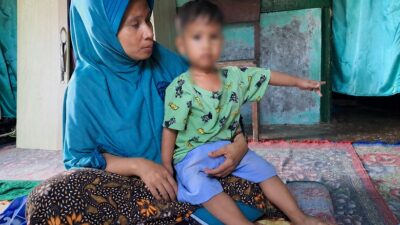 Bocah Penderita Bocor Jantung di Pariaman Butuh Bantuan untuk Biaya Operasi